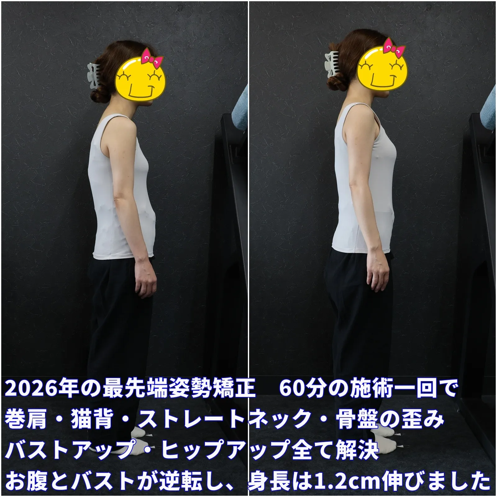 2026年最先端姿勢矯正は通院一回で理想の矯正が目指せる徳島県板野郡藍住町の整体